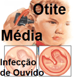 otite