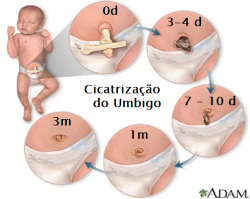 umbilical-cicatriz