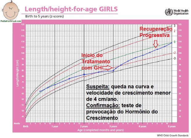 1 - Altura 0-5a - deficiencia de hormonio do crescimento GH